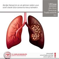 1-30 Kasım Akciğer Kanseri Farkındalık Ayı