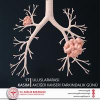 17 Kasım Uluslararası Akciğer Kanseri Farkındalık Günü